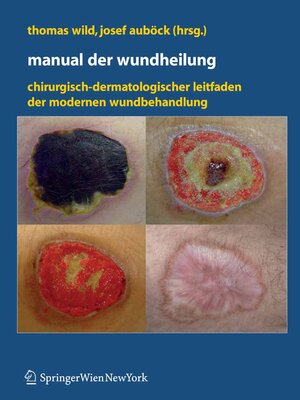 cover image of Manual der Wundheilung